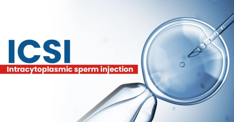 Intra-Cytoplasmic Sperm Injection (ICSI) - Shivam IVF