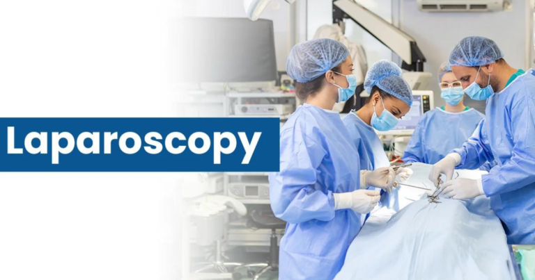 Laparoscopy - Shivam IVF